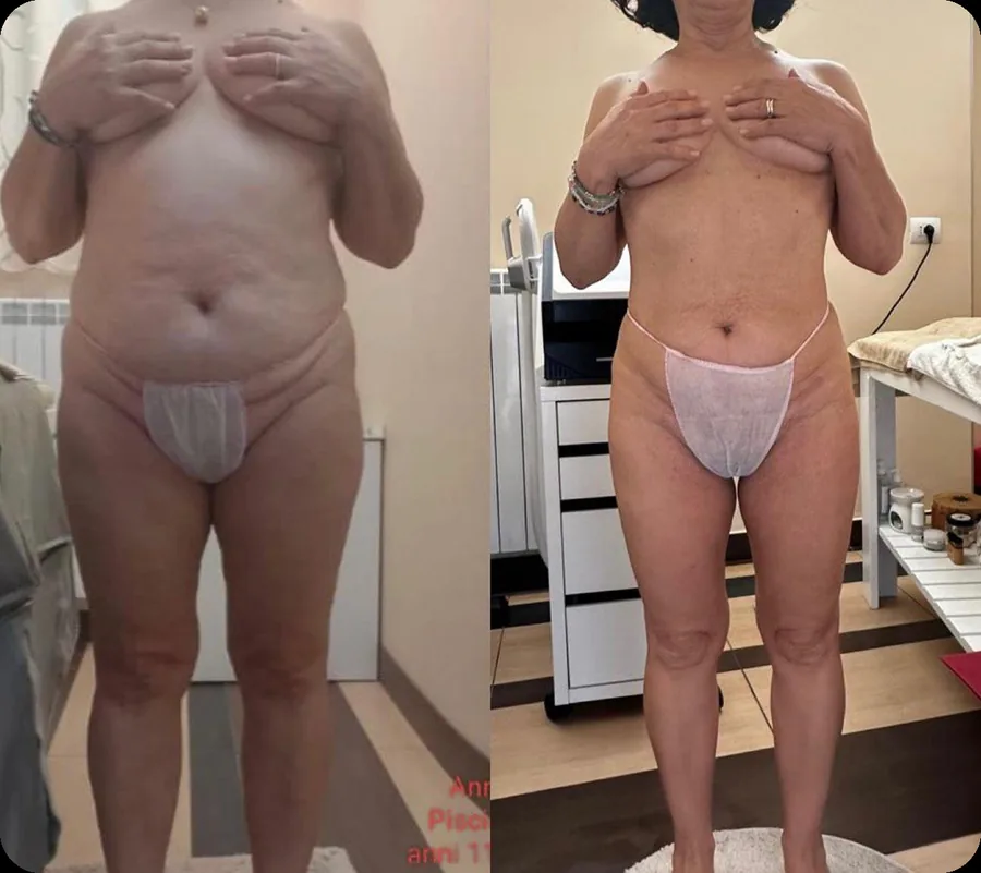 Risultato reale Body Reset 2