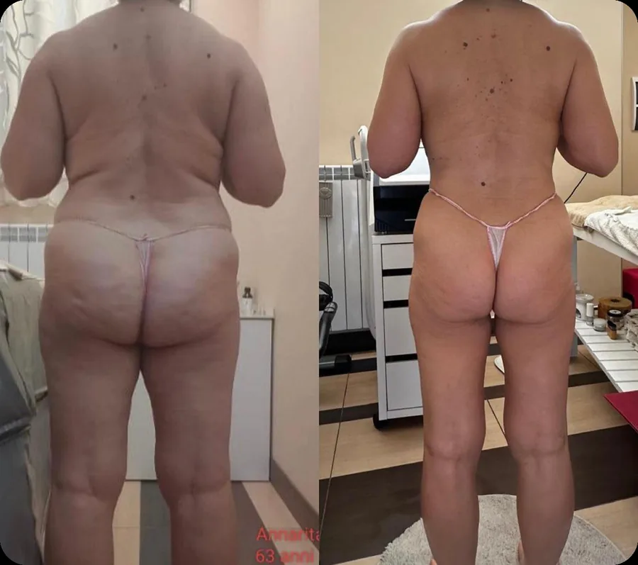 Risultato reale Body Reset 3
